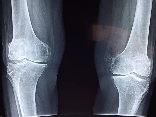 연골 자연 재생-무릎 연골 재생: 자연치유와 줄기세포 연골재생술